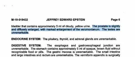 prostatis3.webp
